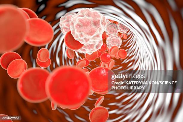 stockillustraties, clipart, cartoons en iconen met blood vessel inflammation, illustration - menselijke slagader