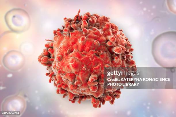 stockillustraties, clipart, cartoons en iconen met leukaemia blood cell, illustration - tumor