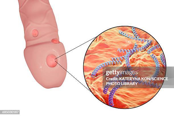 male syphilis, illustration - treponema pallidum stock illustrations