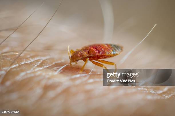 Bed bug feeding on human skin.