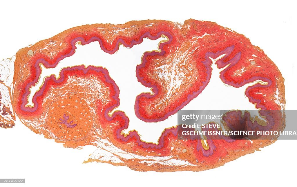 Cervix, LM