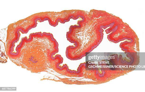 cervix, lm - endomètre photos et images de collection