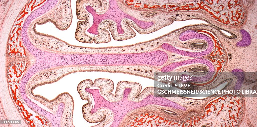 Nasal sinuses, LM