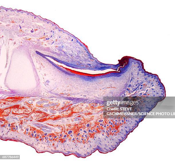 fingertip, lm - stratified squamous epithelium stock pictures, royalty-free photos & images