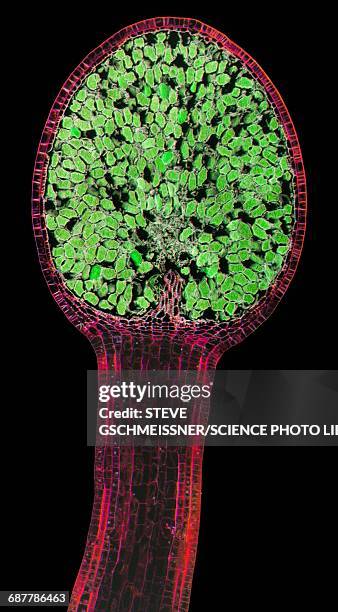 liverwort spore capsule, lm - microscopie optique photos et images de collection