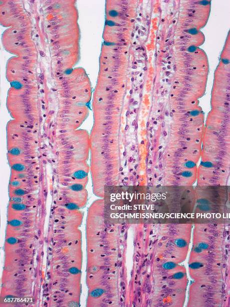 small intestine, lm - villus fotografías e imágenes de stock