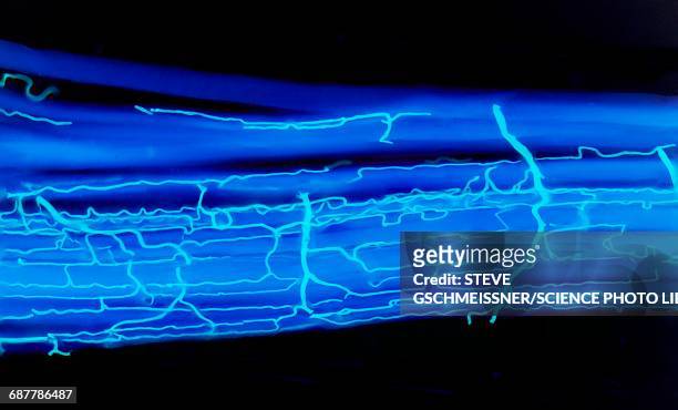 blood supply to muscles, lm - skeletal muscle stock pictures, royalty-free photos & images