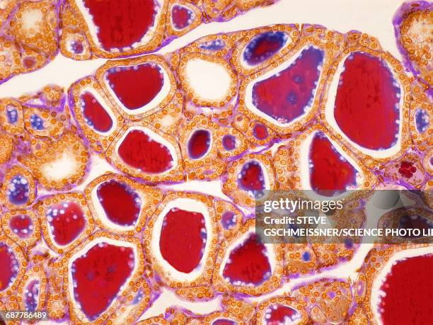 thyroid, lm - parts of human cells stock-fotos und bilder