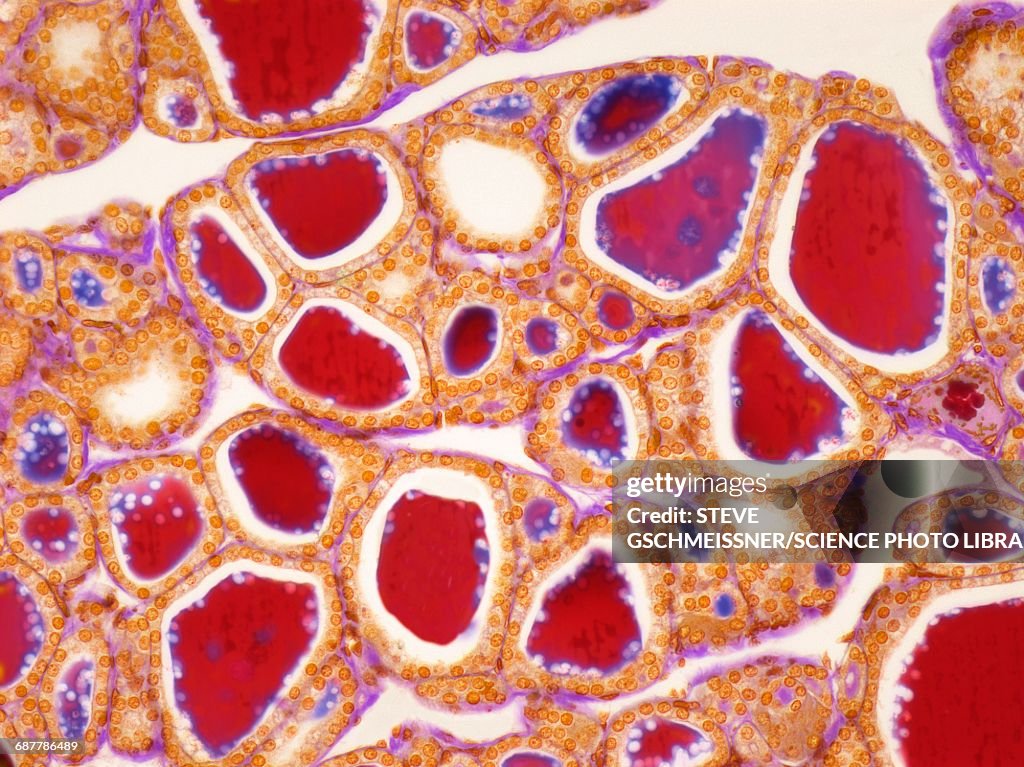 Thyroid, LM