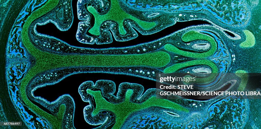 Nasal sinuses, LM