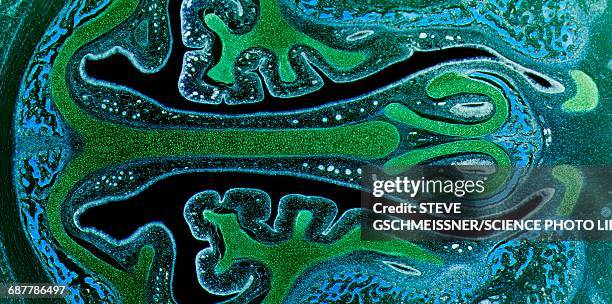 nasal sinuses, lm - tejido humano fotografías e imágenes de stock