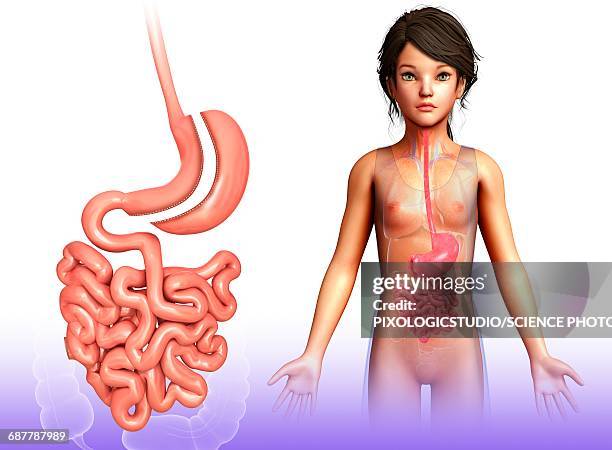 sleeve gastrectomy, illustration - bariatrics stock illustrations