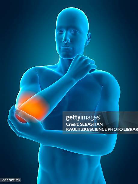 human elbow pain, illustration - elbow stock illustrations
