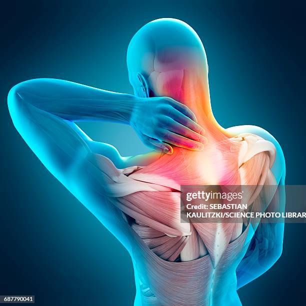 illustrazioni stock, clip art, cartoni animati e icone di tendenza di human neck pain, illustration - dolore fisico