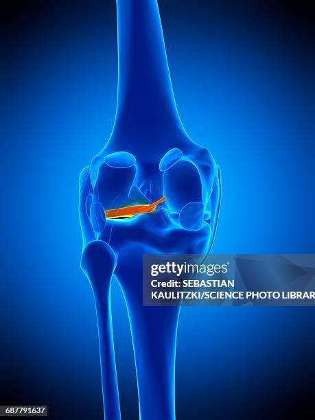 knee meniscus, illustration - knorpel stock-grafiken, -clipart, -cartoons und -symbole