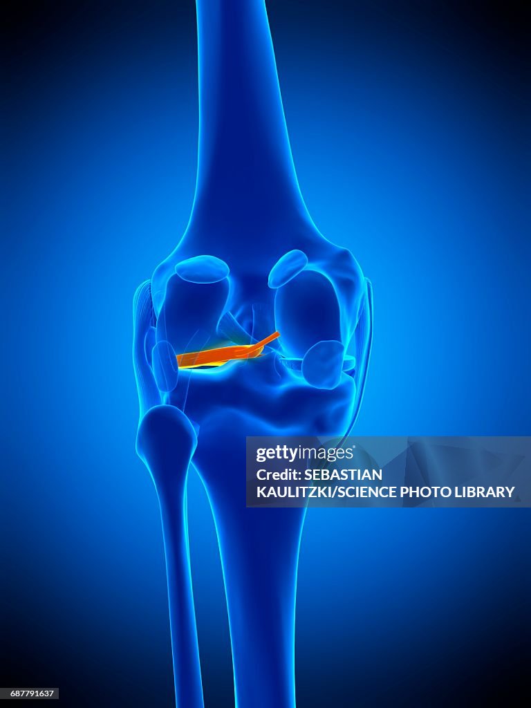 Knee meniscus, illustration