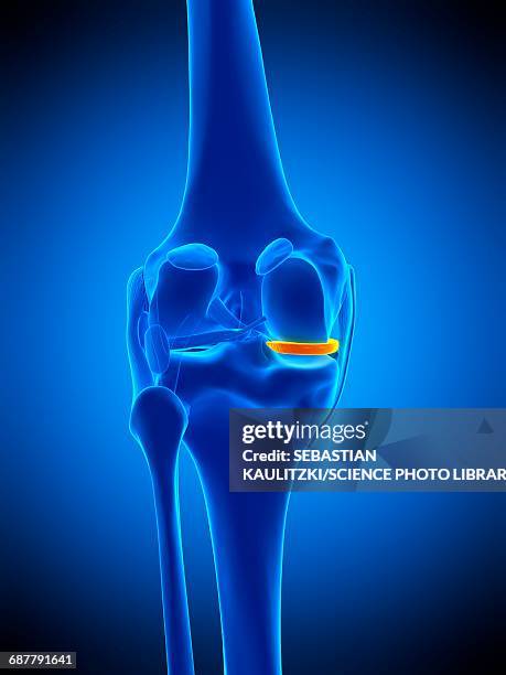 knee meniscus, illustration - medial meniscus stock illustrations