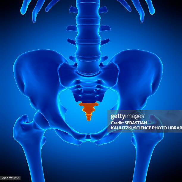 coccyx bone, illustration - rheumatism 幅插畫檔、美工圖案、卡通及圖標