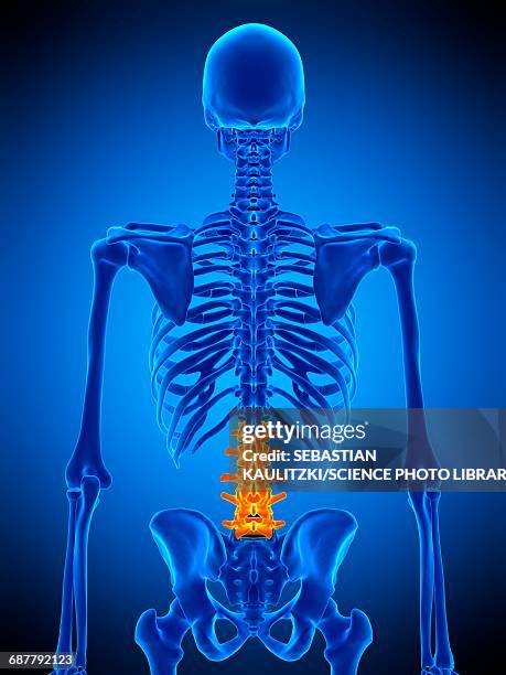 lumbar spine, illustration - gout stock illustrations