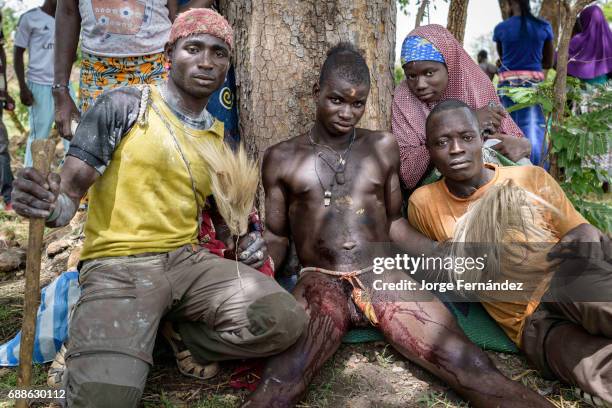 For the Yom tribe, the circumcision ceremony is a very important rite of passage from boys to men. After being circumcised, the penis of the initiate...