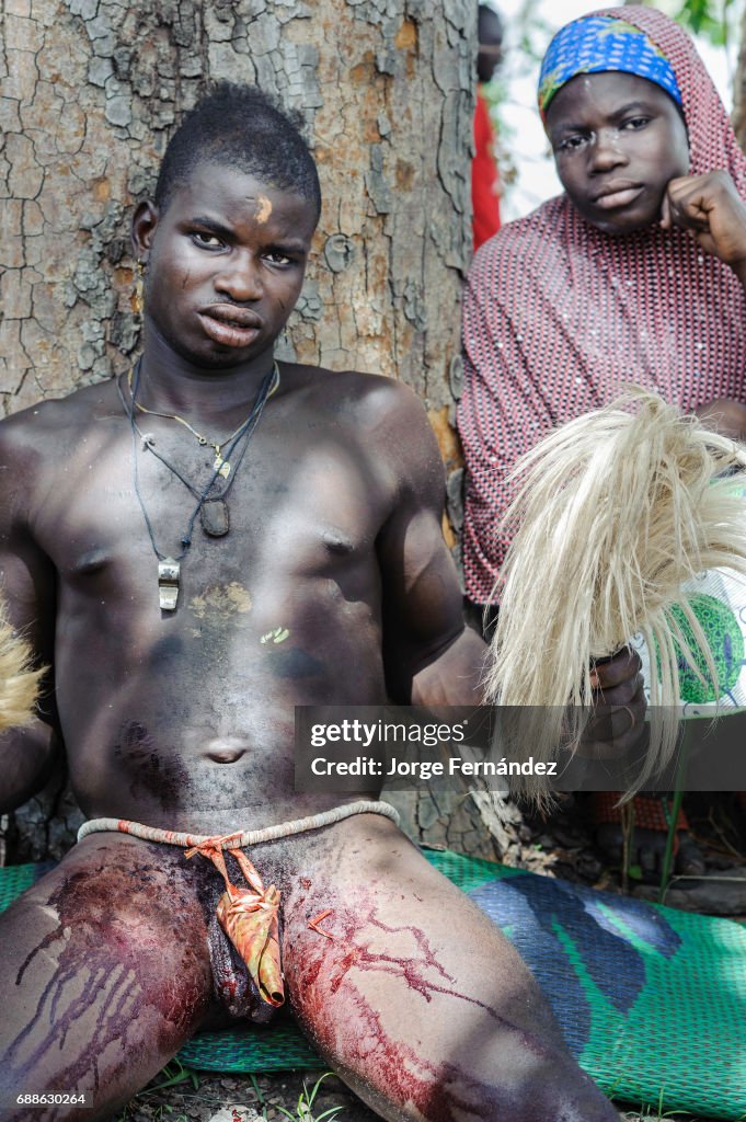 Circumcision Ceremony in Benin