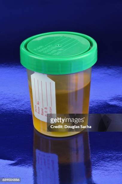 bodily fluid sample - urine sample stock-fotos und bilder