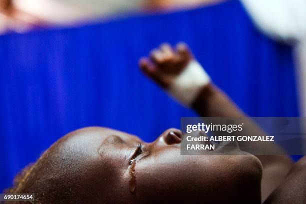 Achol Ri, a 1.5-year-old chid with severe malnutrition, cries after being attended, on May 30 at the clinic run by Doctors Without Borders in Aweil,...