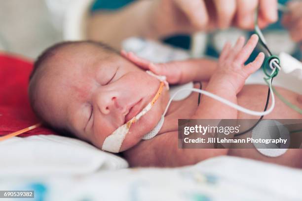 premature baby in nicu in his isolette - baby frowning stock pictures, royalty-free photos & images