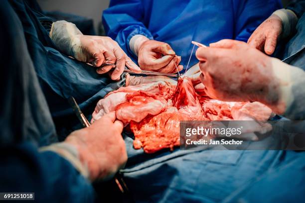 Team of doctors perform a life-saving surgery on a young gang member with several gunshot wounds at the emergency department of a public hospital on...