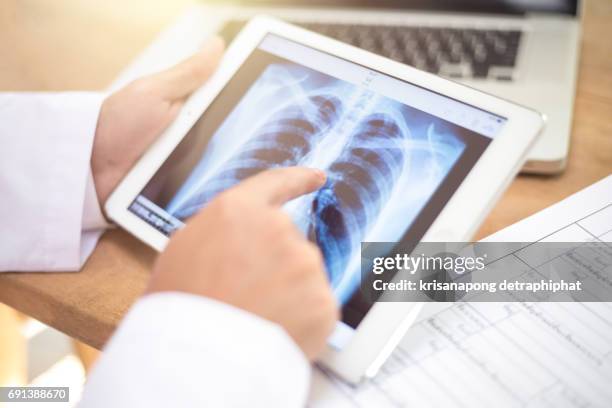 closeup of a young caucasian doctor man sitting at his office desk observing a chest radiograph in a tablet computer - x ray image stock-fotos und bilder