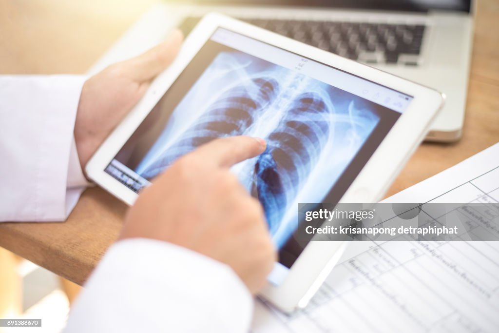 Closeup of a young caucasian doctor man sitting at his office desk observing a chest radiograph in a tablet computer