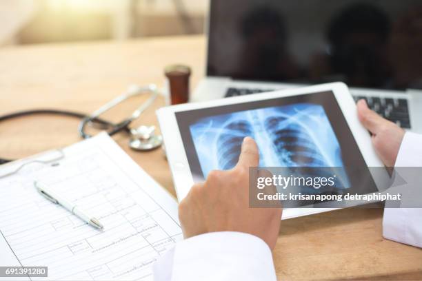 Chest X Ray Computer 240 Chest X Rays Stock Photos, High-Res Pictures, and Images - Getty Images