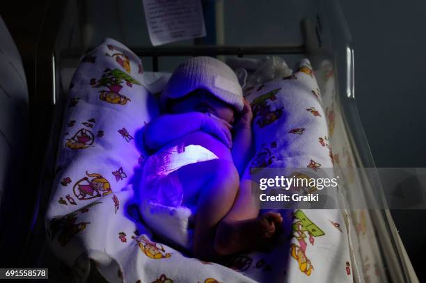 newborn boy treated by ultraviolet light in incubator to solve jaundice issue - bilirubina foto e immagini stock