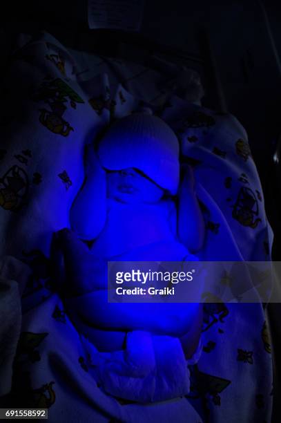 newborn child baby having a treatment for jaundice under ultraviolet light - bilirubina foto e immagini stock
