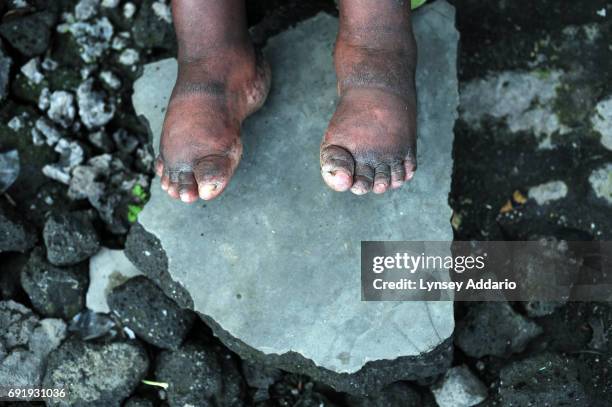 Sifa sits in the Heal Africa shelter in Goma about six months after she was raped in a town in eastern Congo, North Kivu, April 10, 2008. Sifa said...