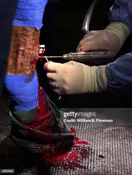 Head surgeon Carl Kirker-Head drills into the front left leg of a three-year-old thoroughbred racehorse at the Tufts University School of Veterinary...