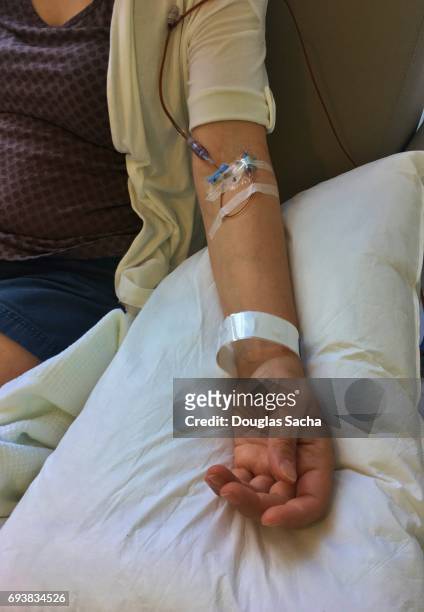 cancer patient in hospital bed with intravenous drip tubes in arm - iv going into an arm stock pictures, royalty-free photos & images