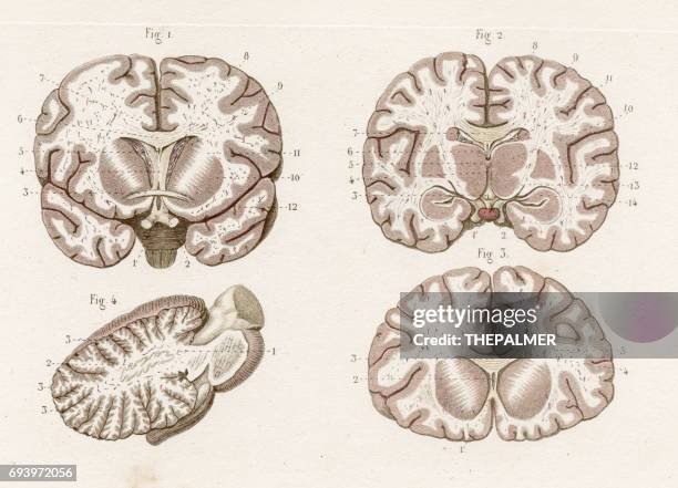 stockillustraties, clipart, cartoons en iconen met transversale gedeelte hersenen anatomie gravure 1886 - pijnappelklier