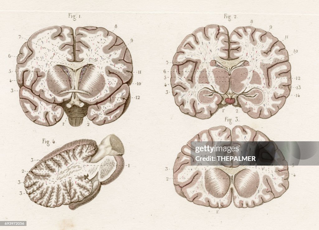 Translinear Brain Transverse Brain Diagram Anatomical Diagrams Of The Brain | E Anatomy