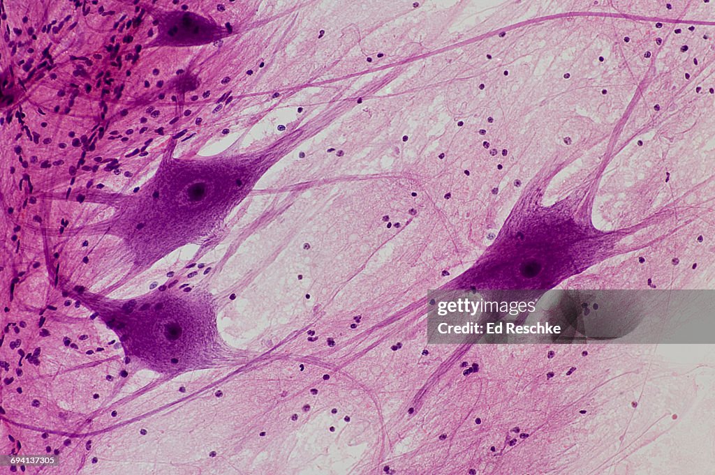 Motor Neurons (Multipolar) with many Processes