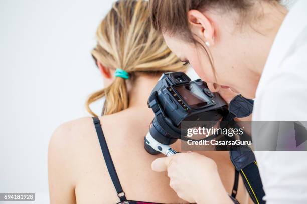 dermatologist inspecting patient skin moles - melanoma stock pictures, royalty-free photos & images