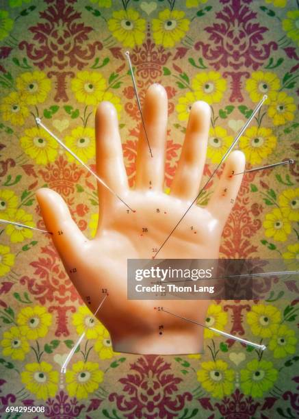 acupuncture hand model with needles - pressure point fotografías e imágenes de stock