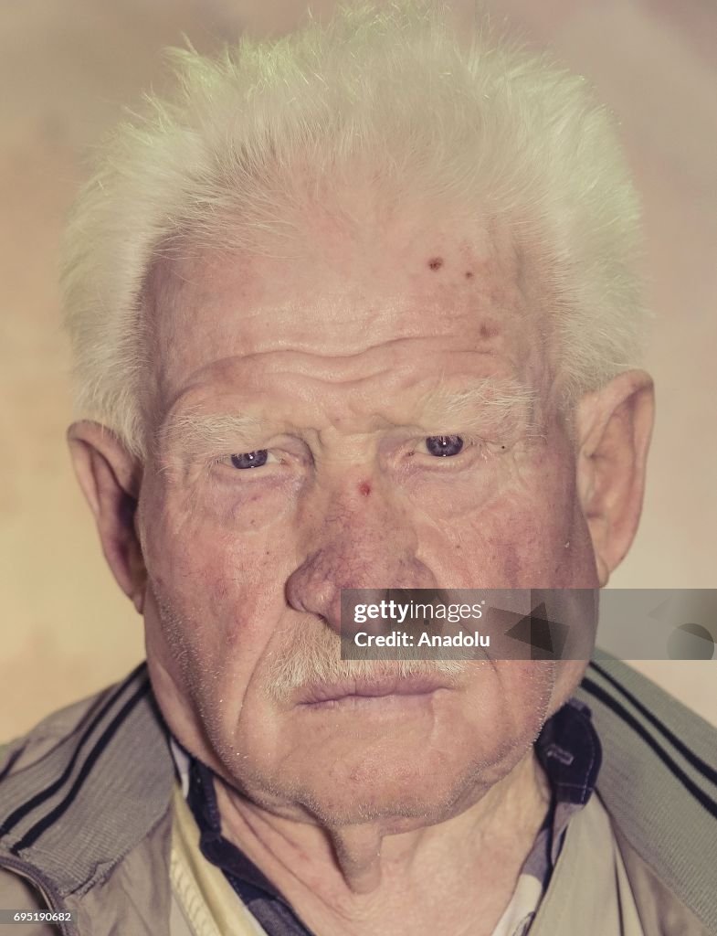 Albinos of Turkey