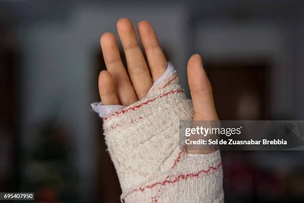 close up of a hand with a bandage - hand laceration stockfoto's en -beelden