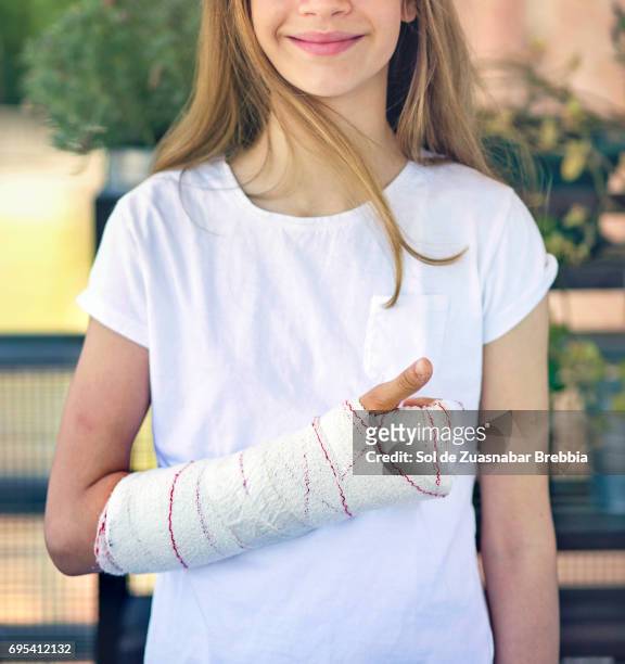 beautiful positive girl smiling with a plastered arm - agony in the garden stockfoto's en -beelden