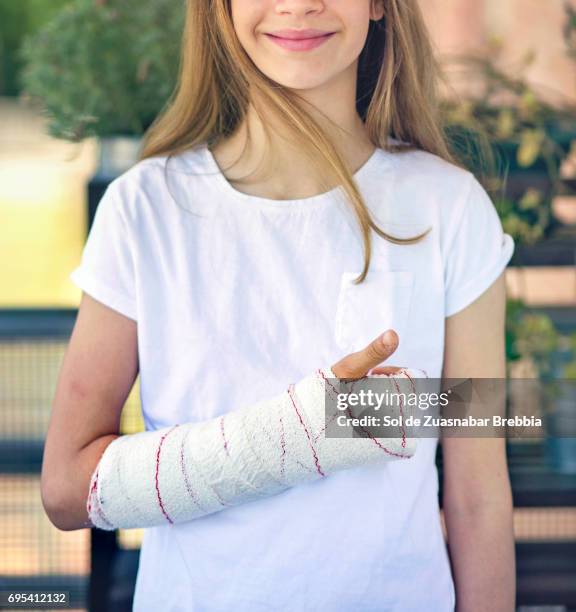 beautiful positive girl smiling with a plastered arm - child having medical bones stock pictures, royalty-free photos & images