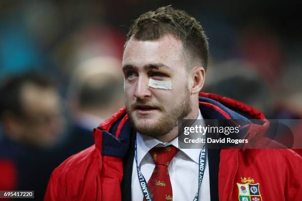 The injured Stuart Hogg of the Lions looks on prior to kickoff during the 2017 British & Irish Lions tour match between the Highlanders and the...