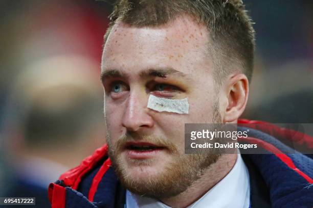 The injured Stuart Hogg of the Lions looks on prior to kickoff during the 2017 British & Irish Lions tour match between the Highlanders and the...