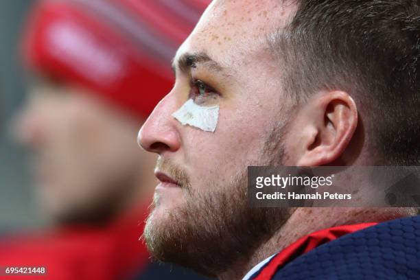 The injured Stuart Hogg of the Lions looks on prior to kickoff during the 2017 British & Irish Lions tour match between the Highlanders and the...