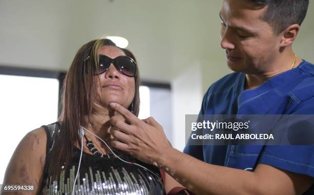 Colombian doctor Alan Gonzalez examines Silvia Julio Jimenez, who survived an acid attack four years ago, in Bogota, Colombia on June 7, 2017. Dr....